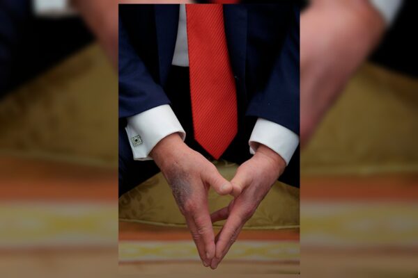 Trump reaparece com mão roxa e Casa Branca fala em reação à aspirina