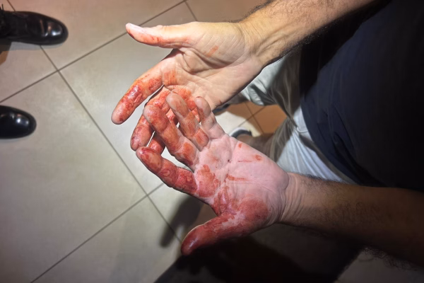 Vídeo mostra tensão em negociação de PMs e rapaz que esfaqueou pai