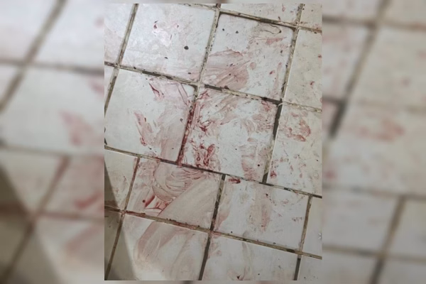 Filho espancado pelo pai suja quarto de sangue na Asa Norte
