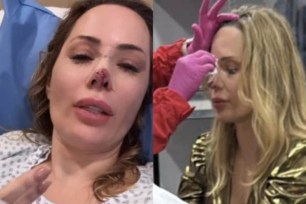 Modelo atacada por cachorro fará 3ª cirurgia para reconstruir nariz