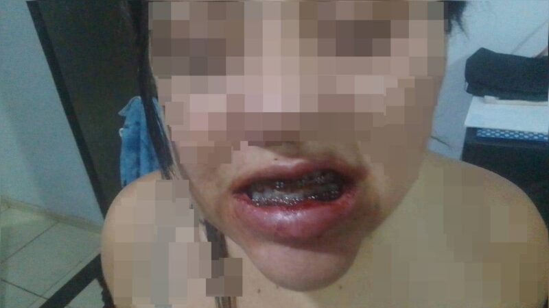 Veja como ficou mulher agredida pelo companheiro em escada de prédio