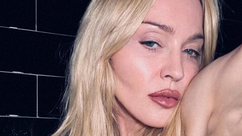 Madonna ficou 4 dias inconsciente e teve sepse após infecção bacteriana