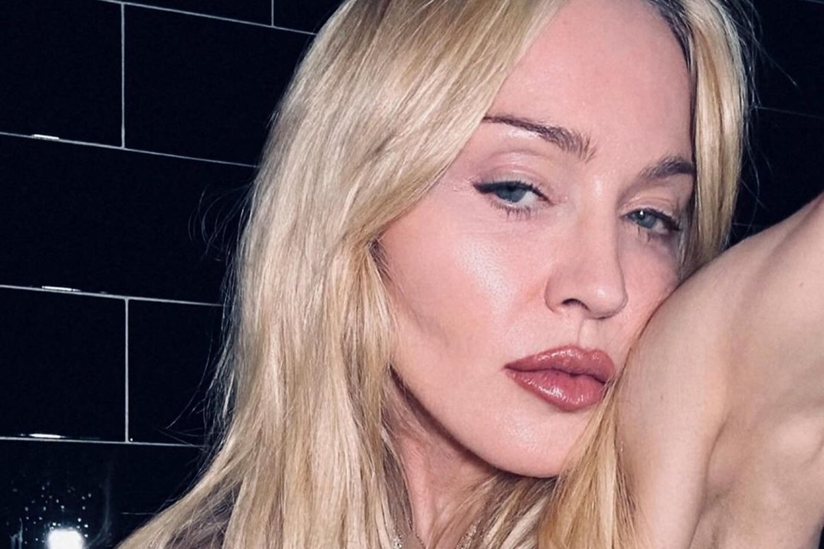 Madonna ficou 4 dias inconsciente e teve sepse após infecção bacteriana