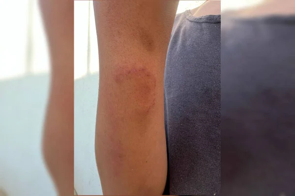 Tortura em casa: mãe amarra filho de 14 anos com extensão e o agride