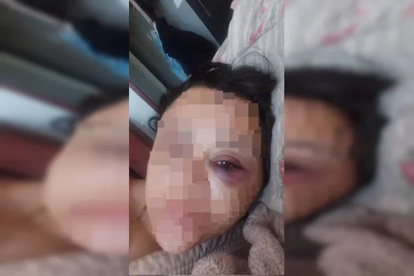 Homem que ameaçou e agrediu companheira desmaiada em escada é preso