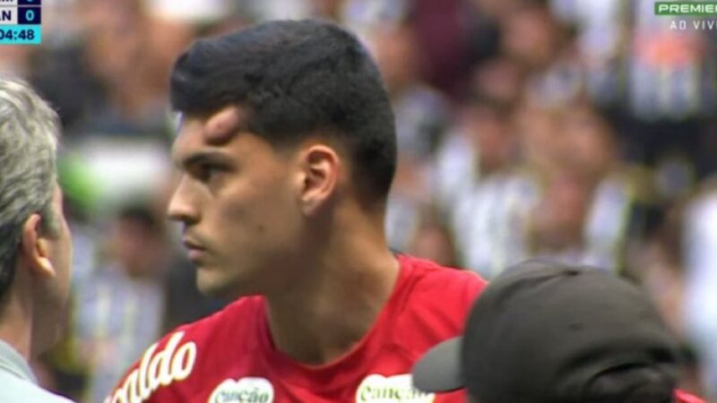 Santos explica decisão de manter Brazão em campo após choque na cabeça