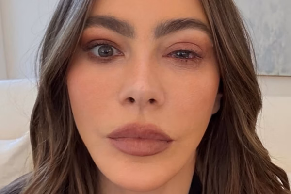 Atriz deixa de ir ao Emmy após reação alérgica no olho; veja foto