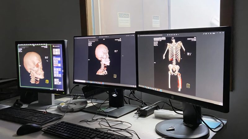 Policiais civis do DF recebem treinamento em radiologia forense