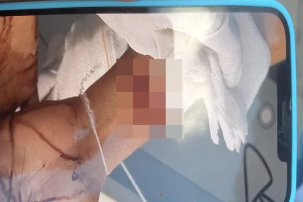 Briga de vizinhos por “barulho de sexo” termina com dois esfaqueados