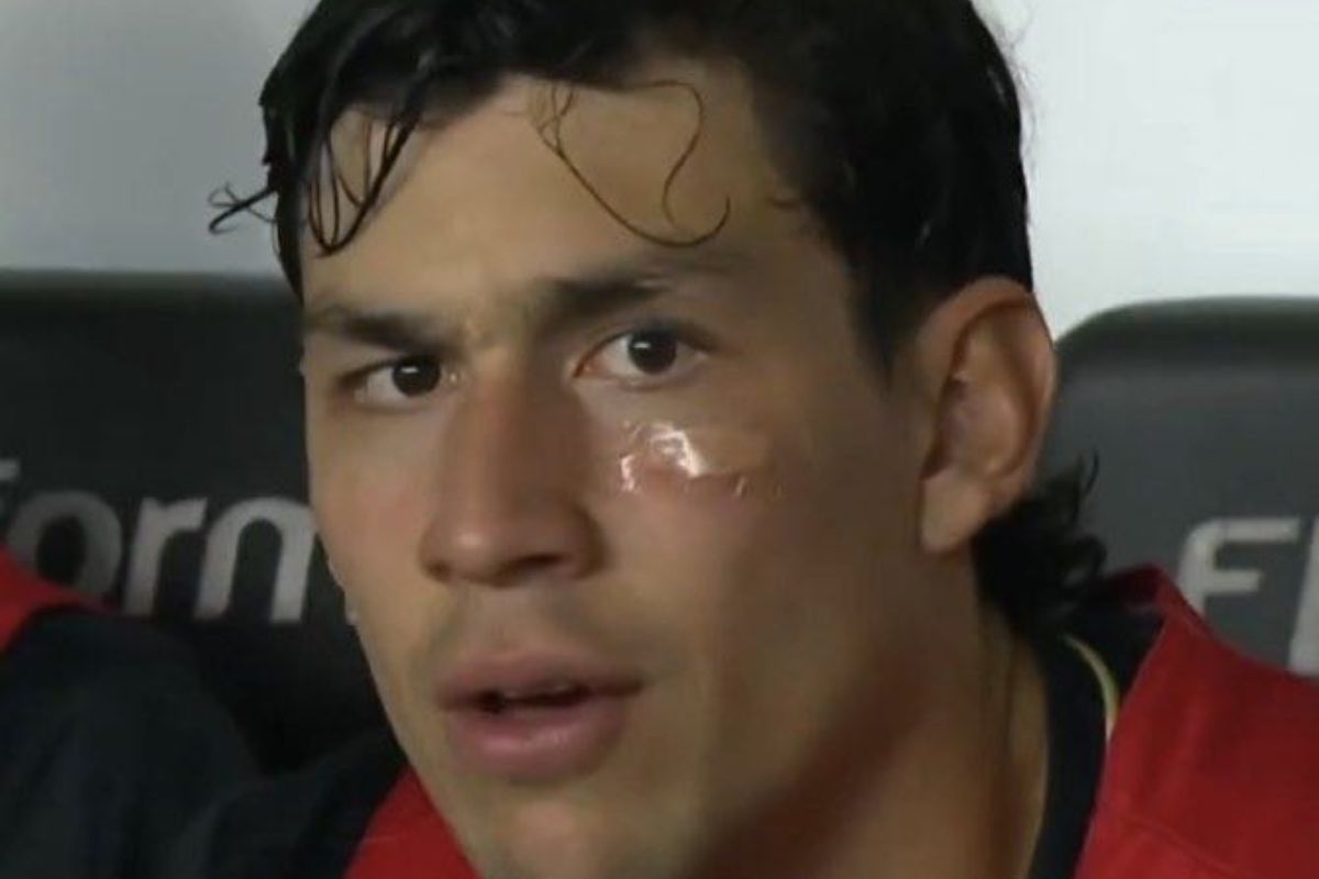 Ferraresi se choca com companheiro de time e leva dois pontos no rosto