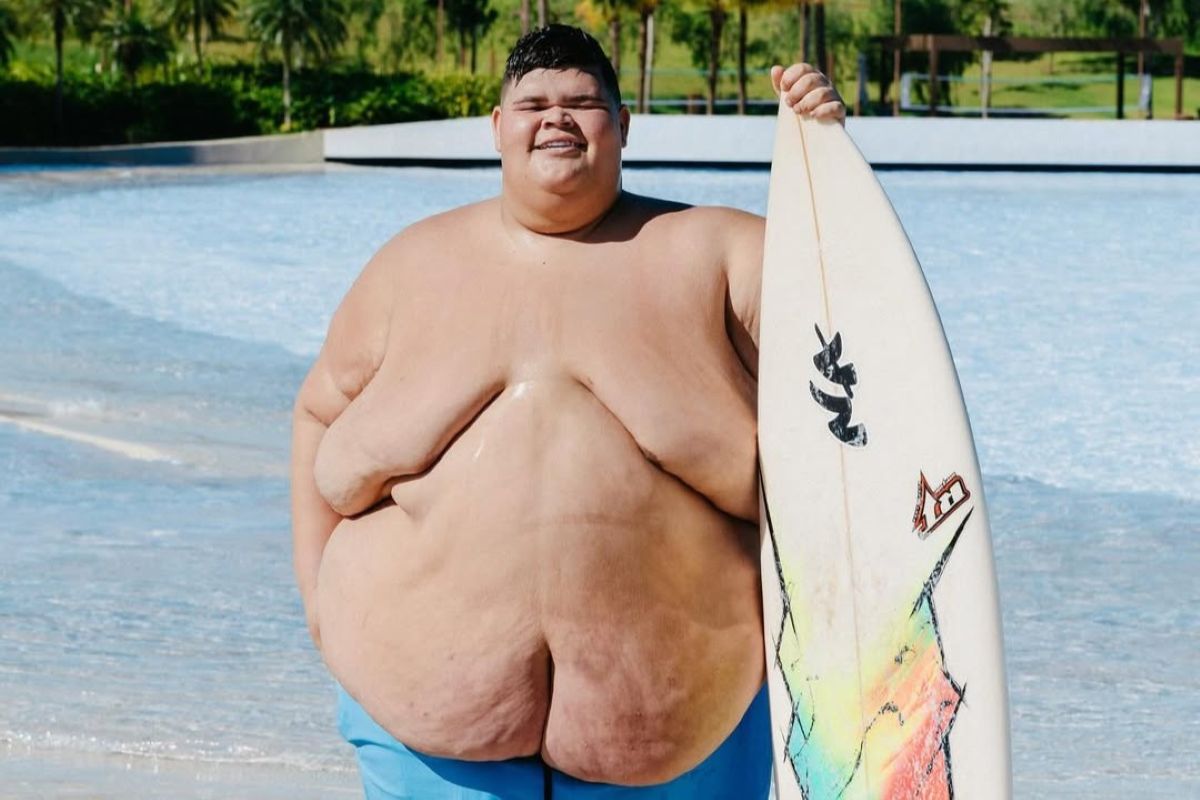 Gordão da XJ bate meta e perde 115 kg: veja antes e depois