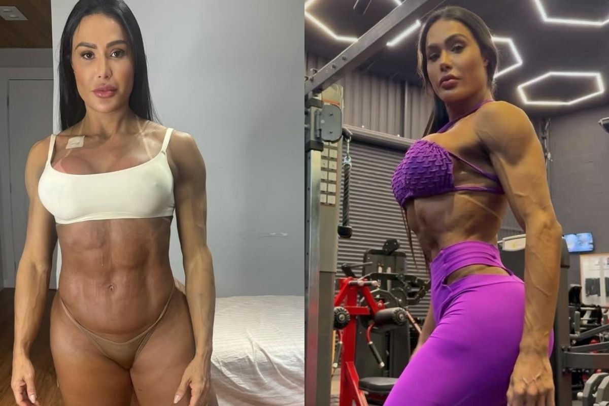 Gracyanne explica ganho de 20 kg após cirurgia: “Tomei um susto”