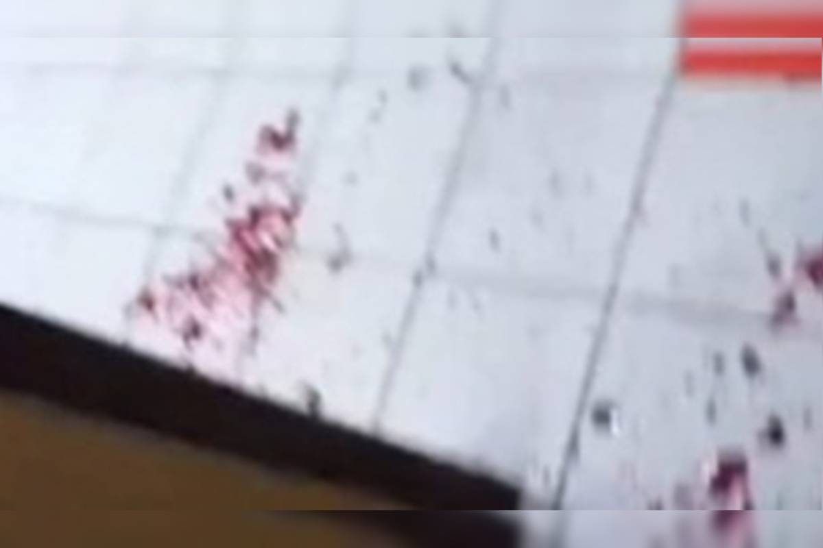 Idosa é atacada por pit-bull solto na rua e salva por jovens em Goiás