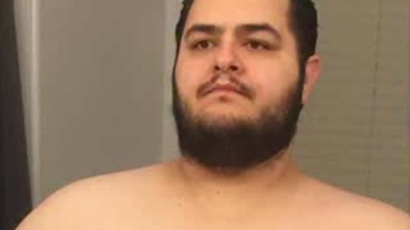 Influenciador surpreende com antes e depois após perder 150 kg