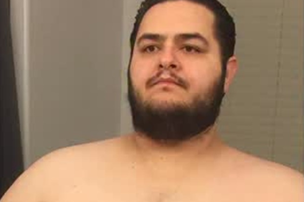 Influenciador surpreende com antes e depois após perder 150 kg