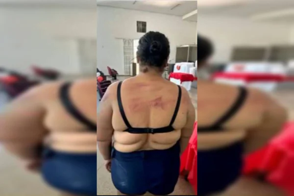 Covardia e crueldade: mulher é golpeada a facão com bebê no colo
