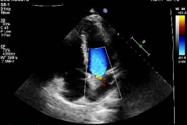 Foto: Vittor Fernando mostra bala no coração após tentativa de assalto