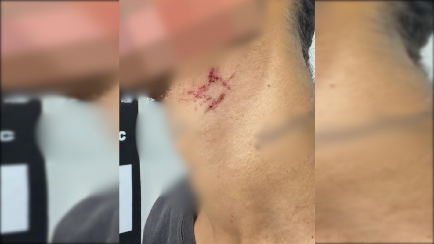 Escravo sexual é resgatado após passar mais de um ano em cárcere