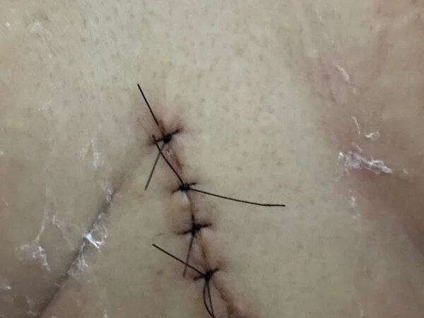 Júri condena homem que emboscou mulher e cravou faca no peito dela