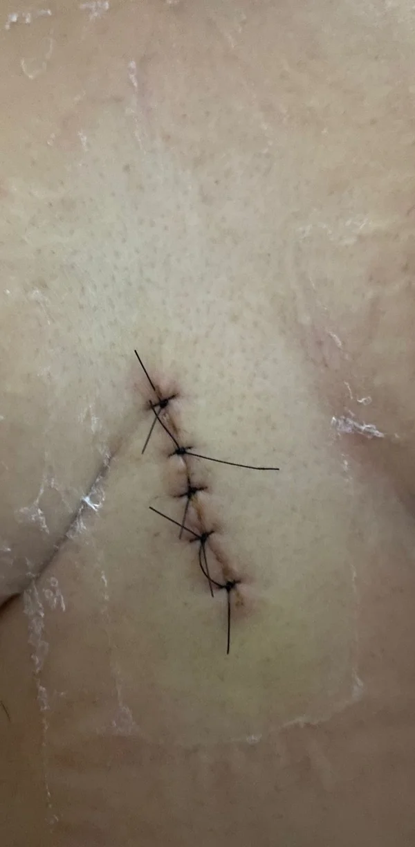 Júri condena homem que emboscou mulher e cravou faca no peito dela