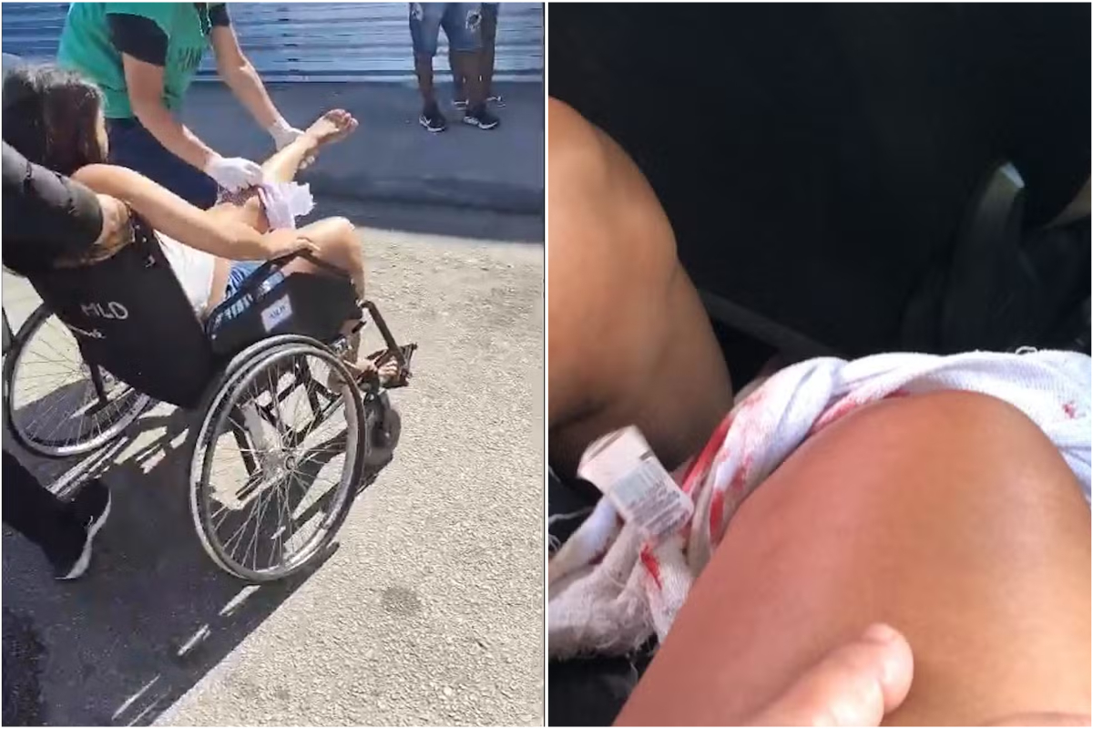 Grávida é baleada durante tiroteio e passa por parto de urgência no RJ