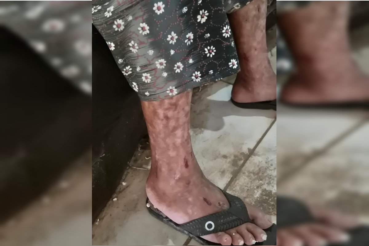 Testemunha ouviu filho que manteve mãe presa gritar: “Morre, velha”