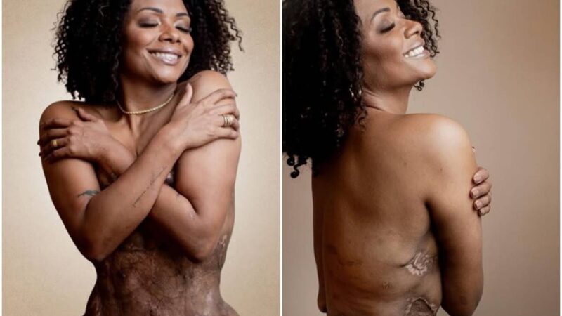 Médico que realizou “cirurgia X-Tudo” em paciente é condenado em SC