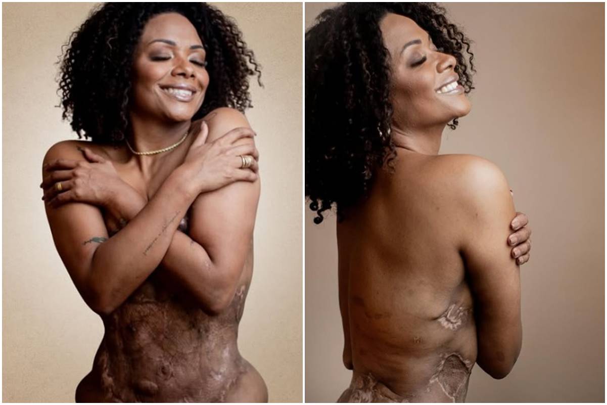 Médico que realizou “cirurgia X-Tudo” em paciente é condenado em SC