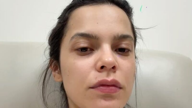 Ex-BBB é internada após sofrer inflamação provocada por contraceptivo