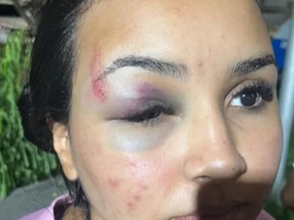 Marido atualiza estado de saúde de funcionária da WePink espancada