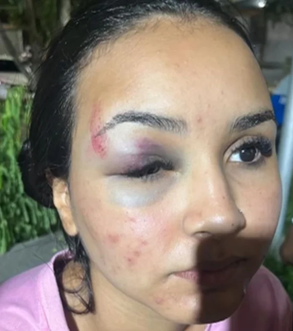 Marido atualiza estado de saúde de funcionária da WePink espancada